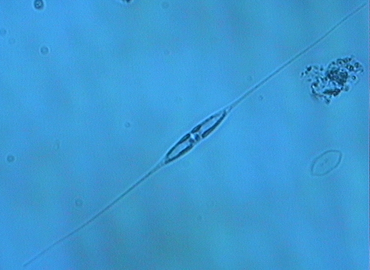 Dictyocha speculum